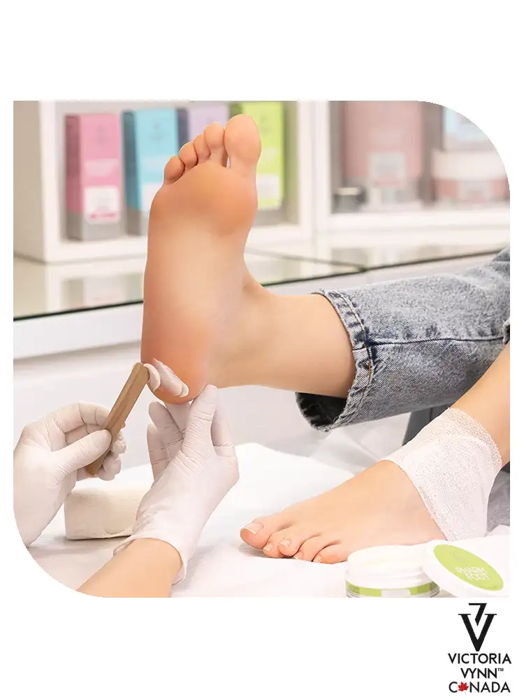 Pharm Foot Best Cracked Heel Repair Ointment Cracked Heel Protector 200ml 1 4