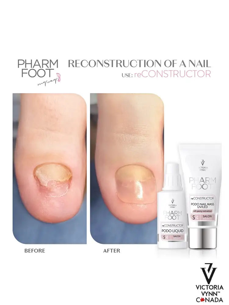 Pharm Foot pedicure toe reconstruction kit reCONSTRUCTOR 30ml 1 3